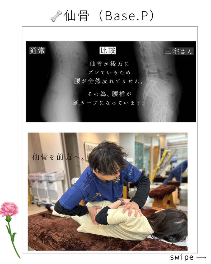 根本原因の特定：アトラスと仙骨の重要性